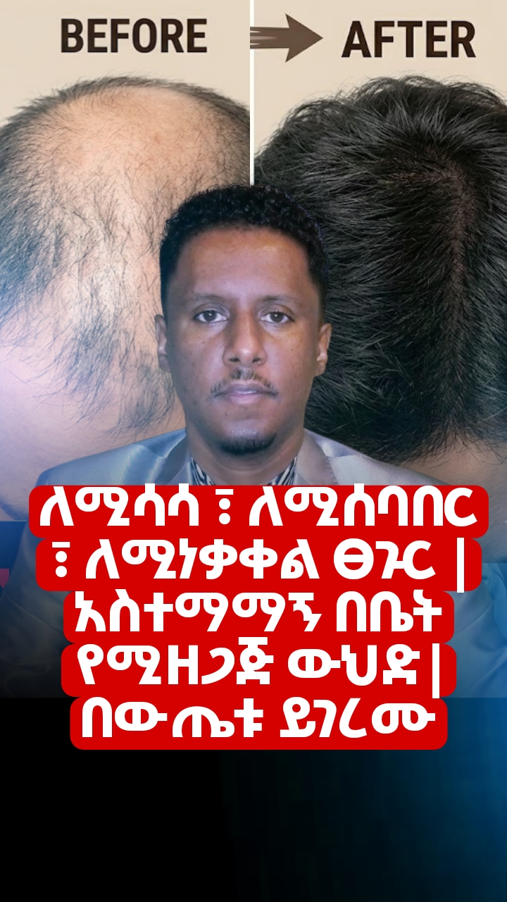 Natural Hair Regrowth thumbnail