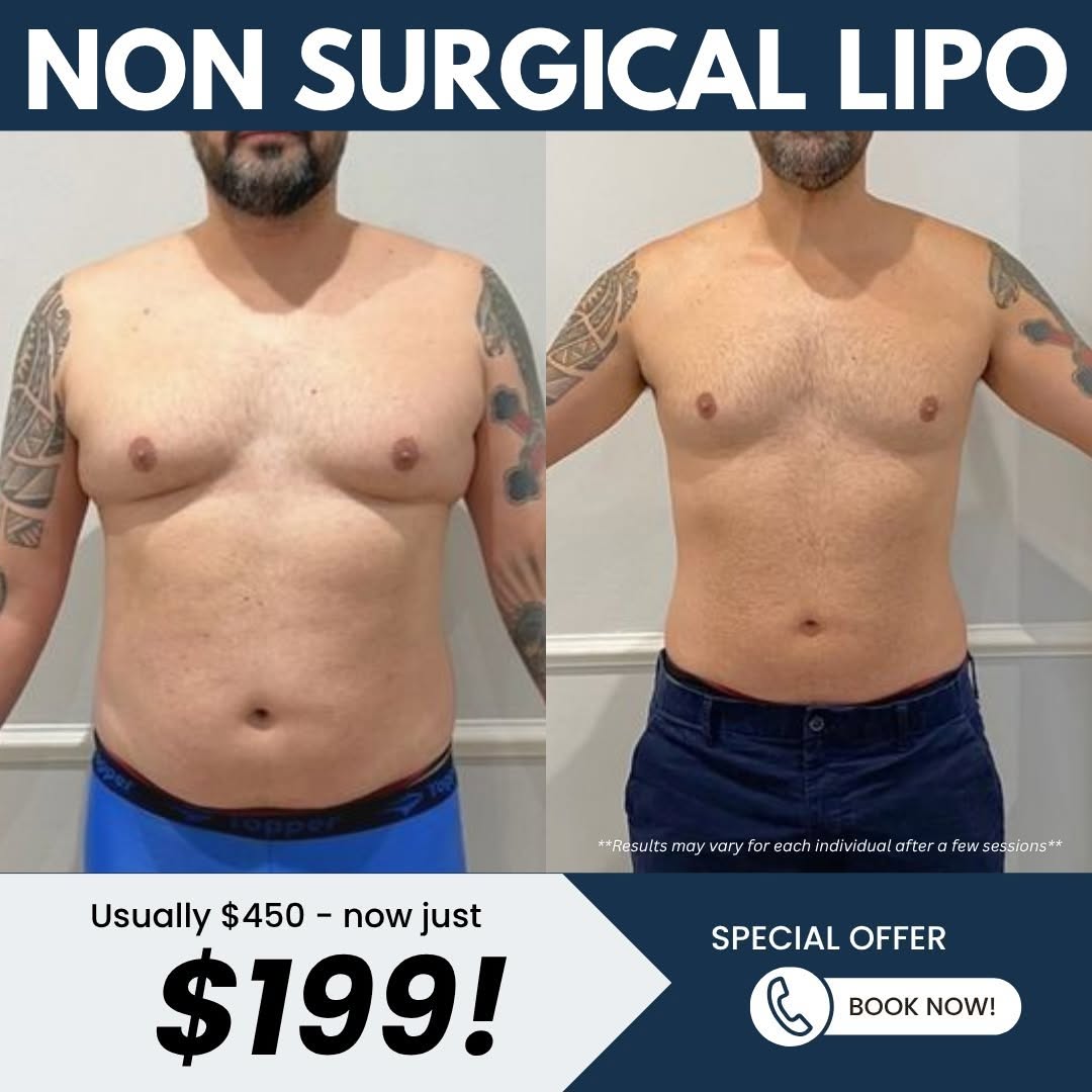 Non Surgical Lipo Deal thumbnail